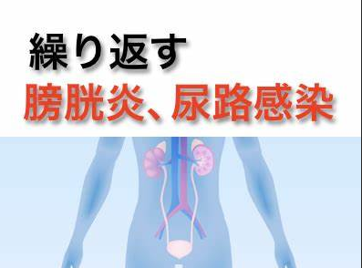 膀胱炎,阜阳膀胱炎医院,阜阳阜亚医院