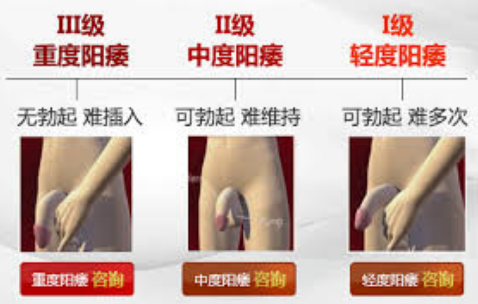 阳痿,阳痿原因,阜阳阳痿原因